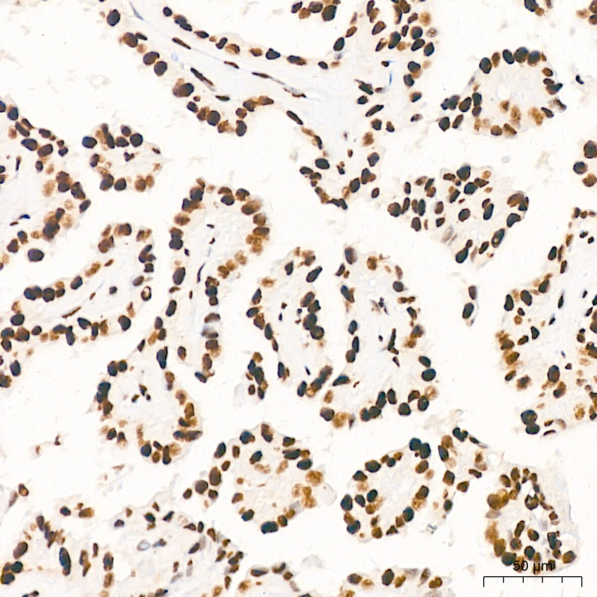 ILF3 Antibody (0S2N7)