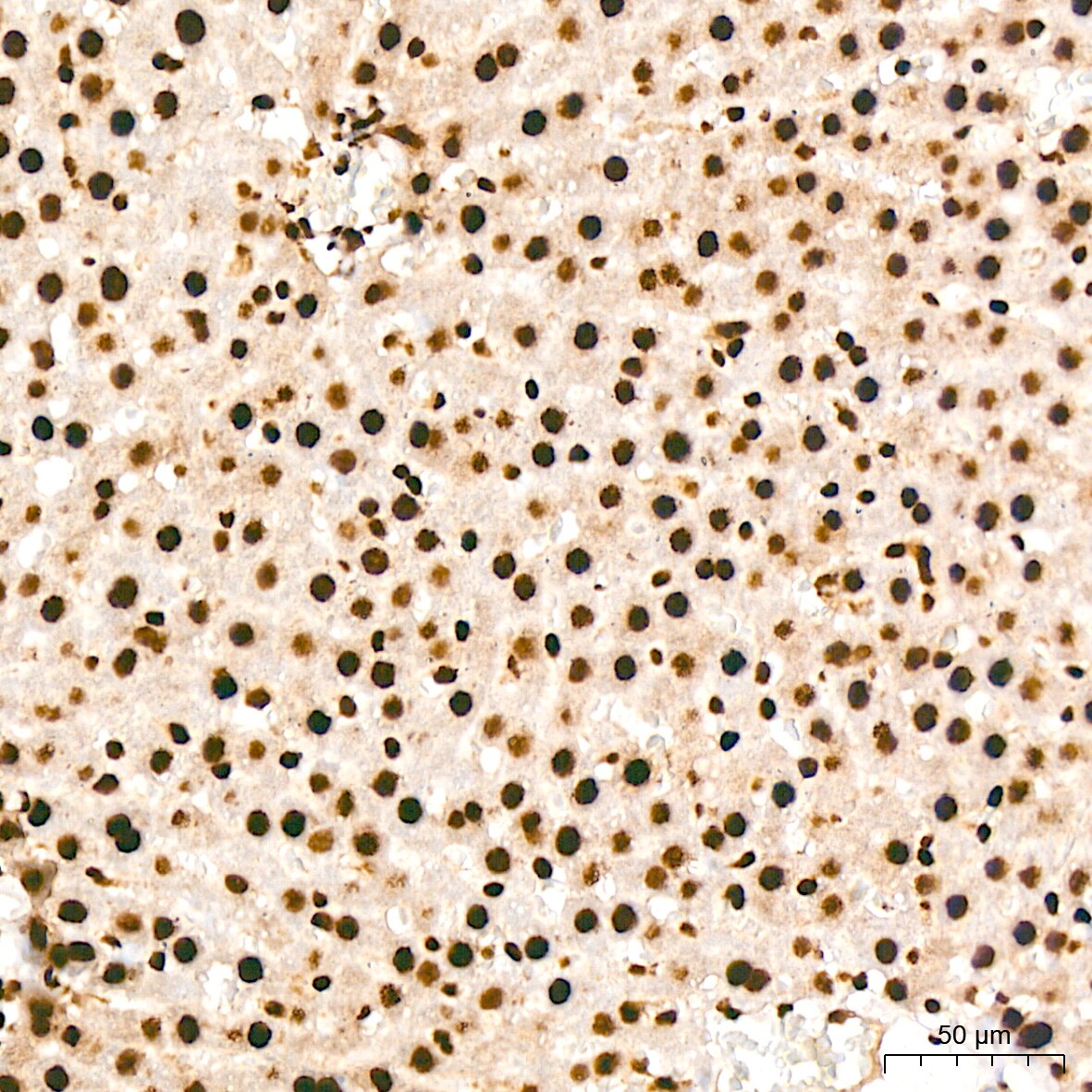 ILF3 Antibody (0S2N7)