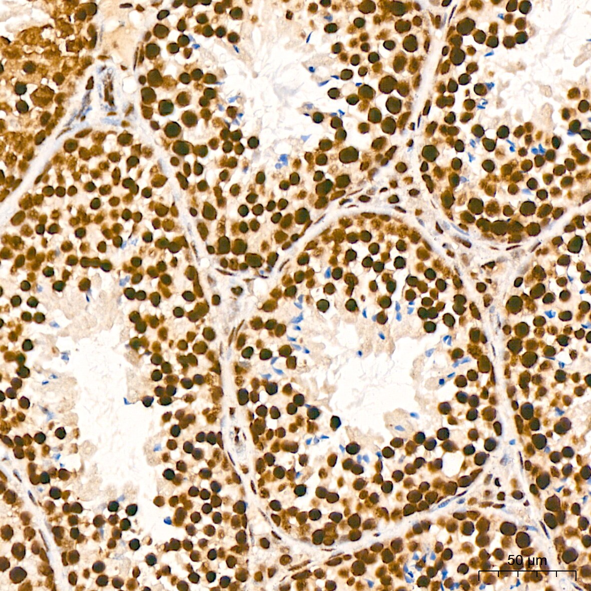 ILF3 Antibody (0S2N7)