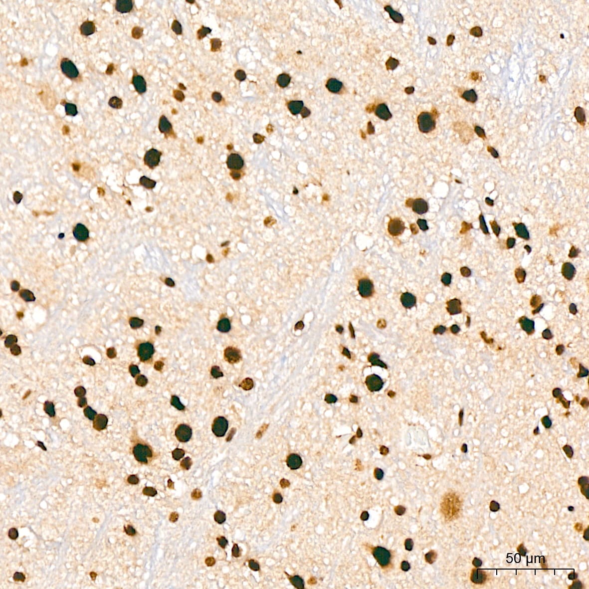 ILF3 Antibody (0S2N7)