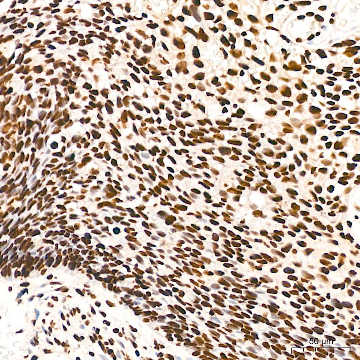 ILF3 Antibody (0S2N7)
