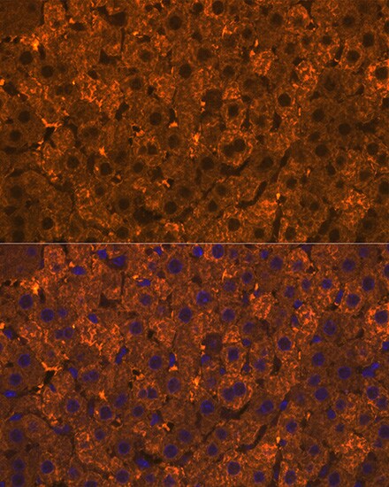 Cytosolic Sulfotransferase 2A1/SULT2A1 Antibody (4A3H6)