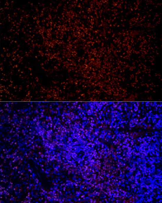Aiolos/IKZF3 Antibody (4U7F9)