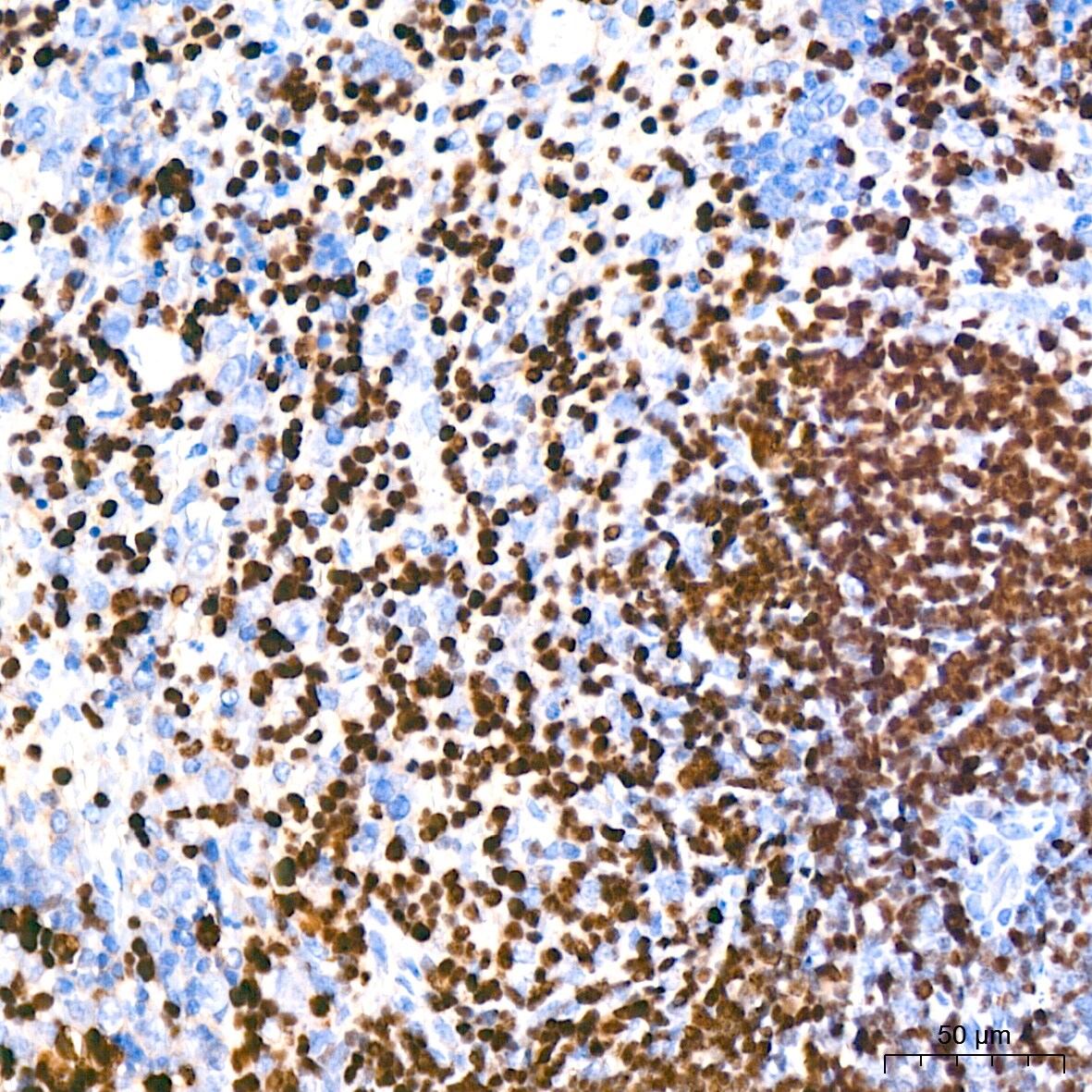 Aiolos/IKZF3 Antibody (4U7F9)
