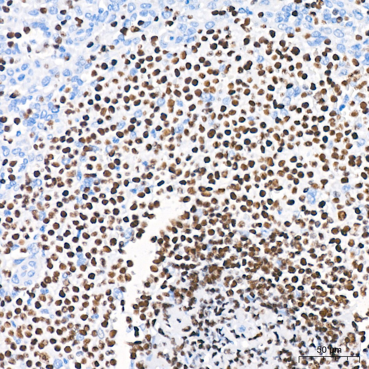 Aiolos/IKZF3 Antibody (4U7F9)