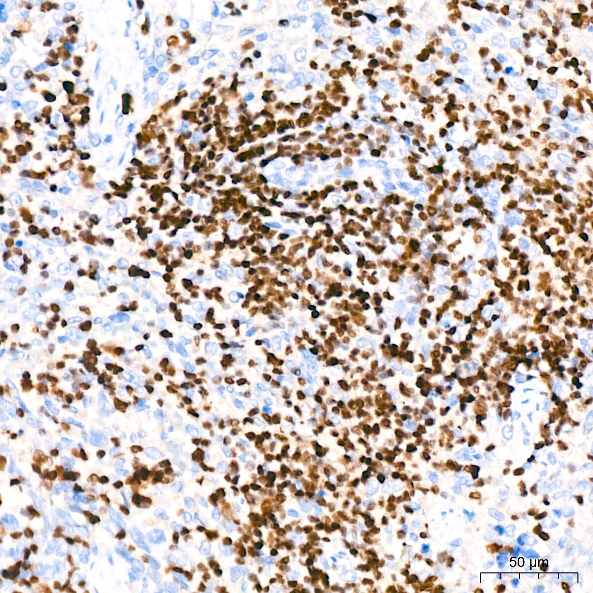 Aiolos/IKZF3 Antibody (4U7F9)