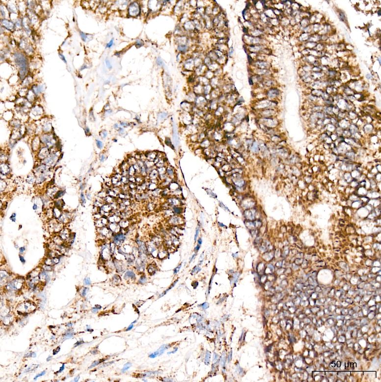 Ndufs4 Antibody (6T10F4)