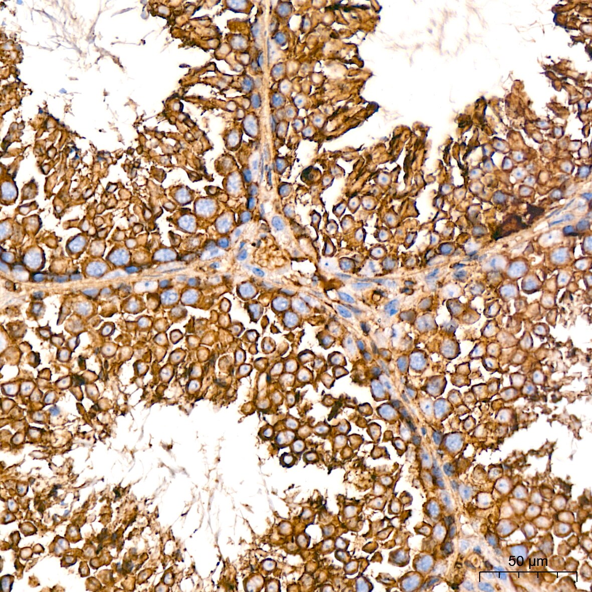 Somatostatin R5/SSTR5 Antibody (4O6N5)