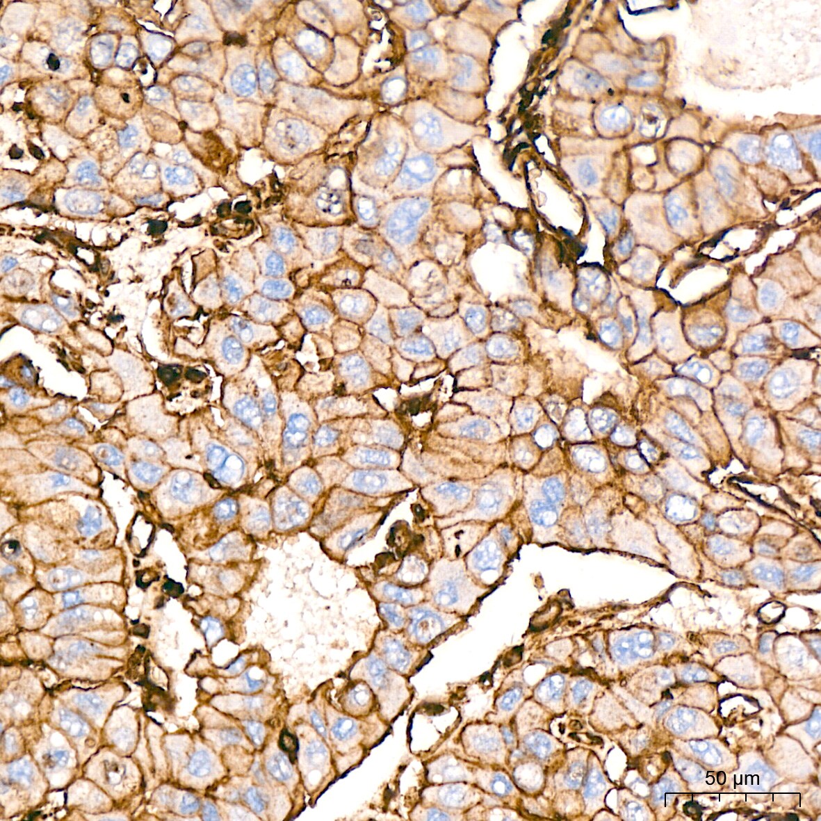 Somatostatin R5/SSTR5 Antibody (4O6N5)