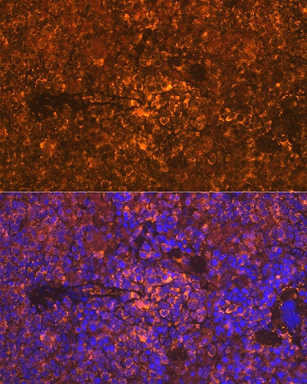 Oncostatin M/OSM Antibody (8O8K9)