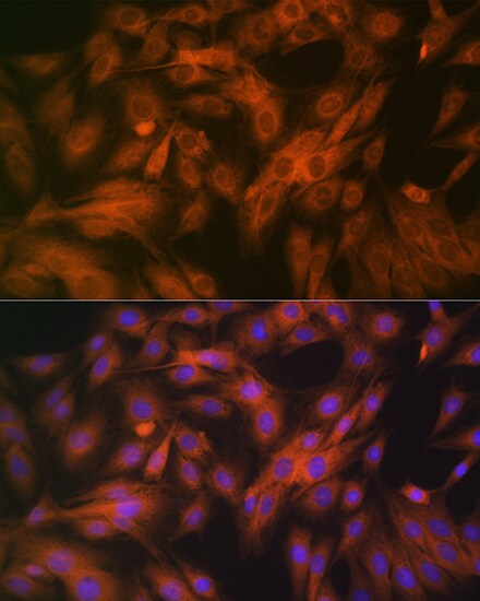 Calpain 1 Antibody (10E6O5)