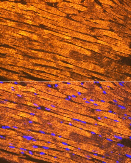 Tropomyosin-1 Antibody (5Q2H6)