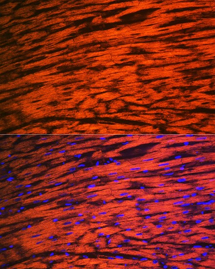 Myosin Light Chain 2 Antibody (5M6Q8)