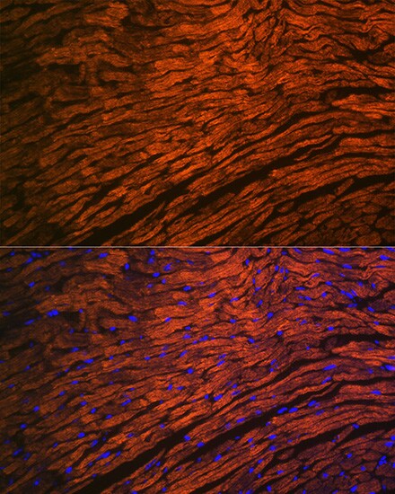 Myosin Light Chain 2 Antibody (5M6Q8)