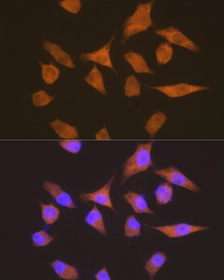 EEF1G Antibody (2E1O7)