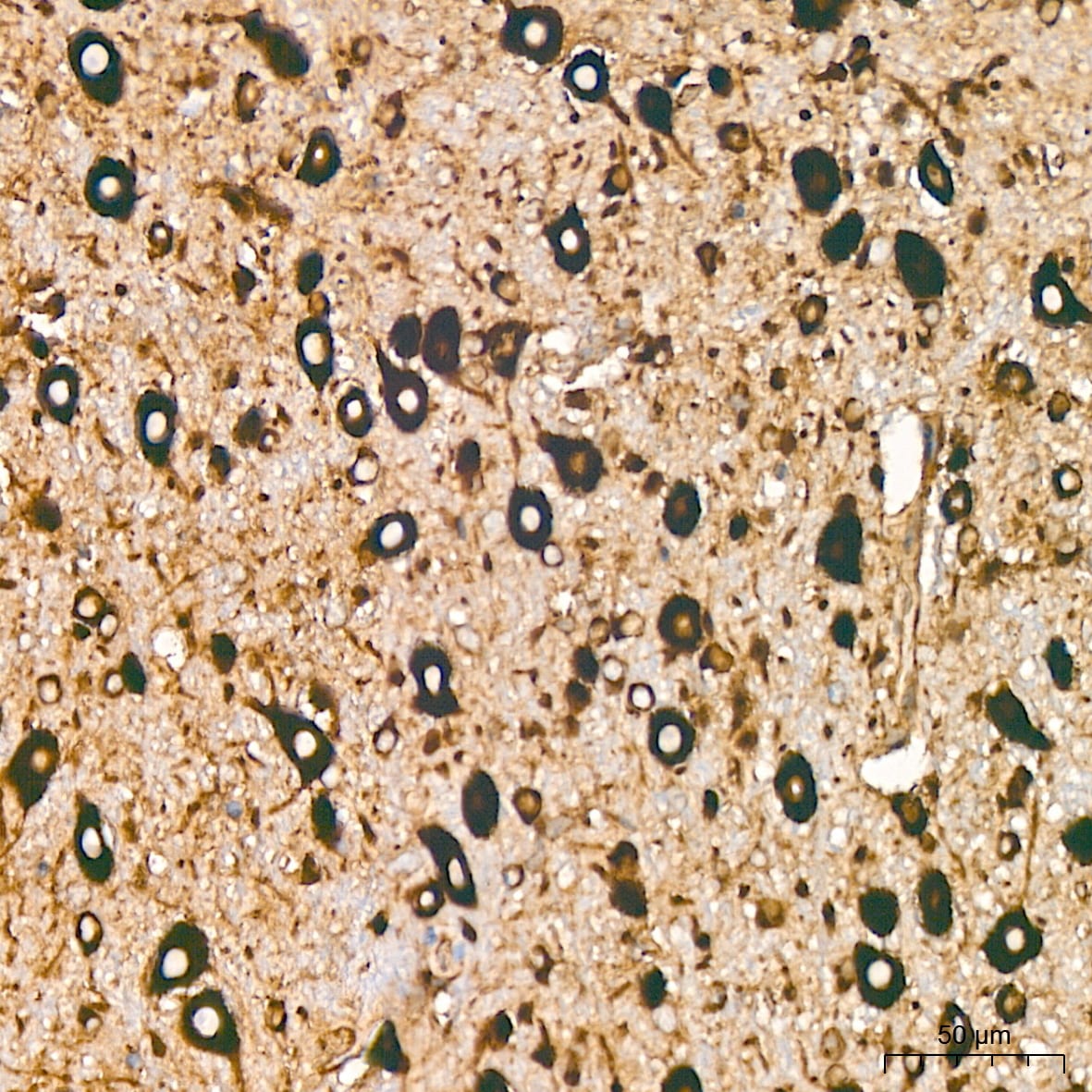 EEF1G Antibody (2E1O7)