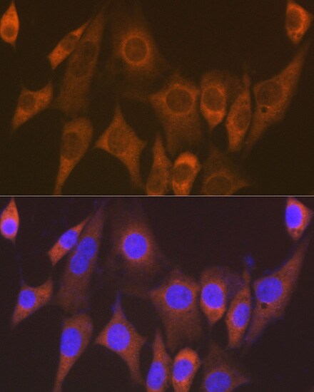 EEF1G Antibody (2E1O7)