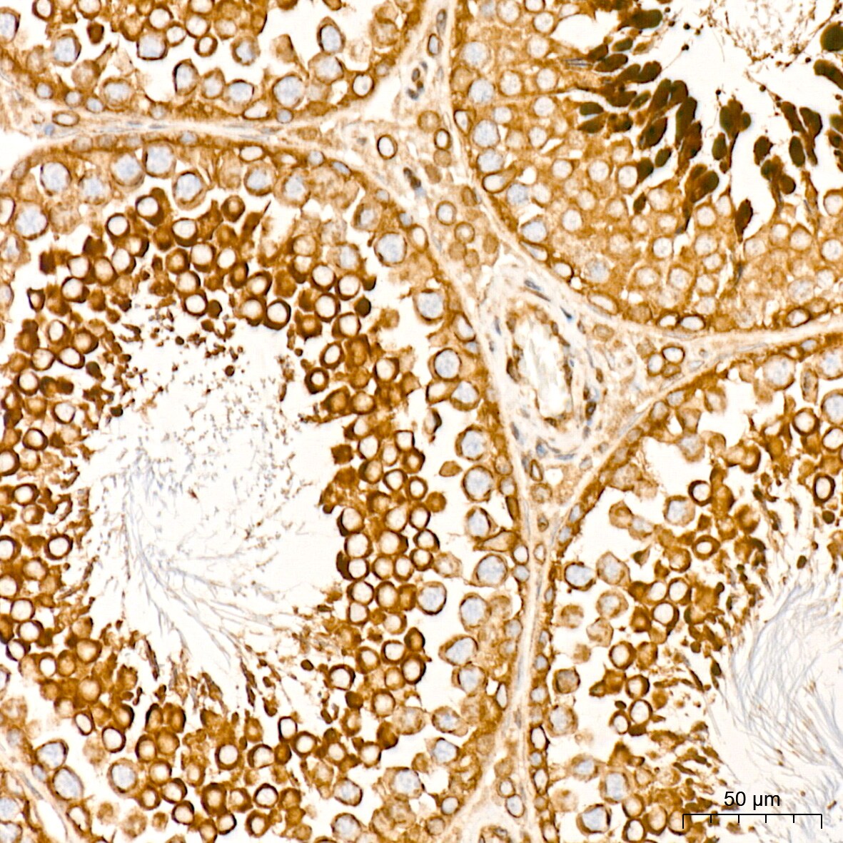 RanGAP1 Antibody (1E7R7)