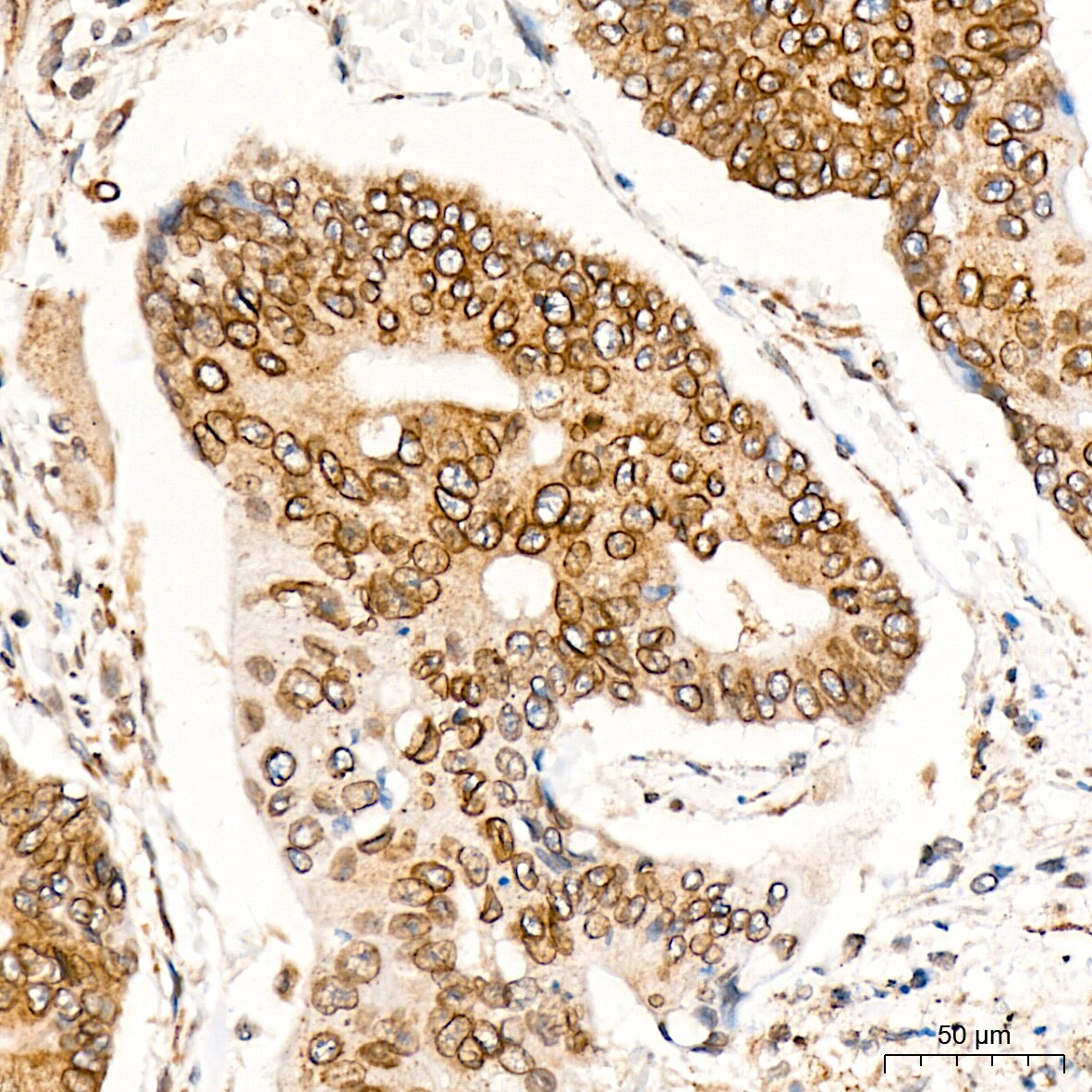 RanGAP1 Antibody (1E7R7)