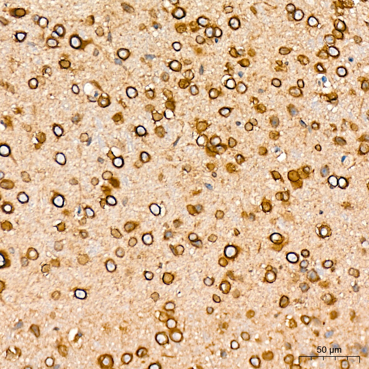 RanGAP1 Antibody (1E7R7)
