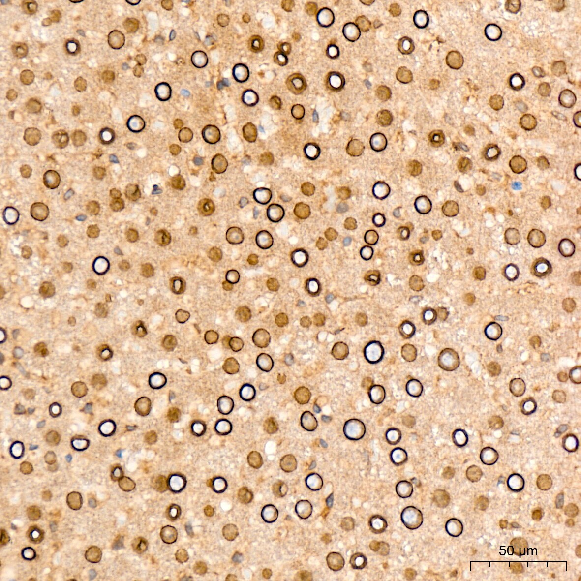 RanGAP1 Antibody (1E7R7)