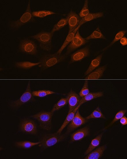 RanGAP1 Antibody (1E7R7)