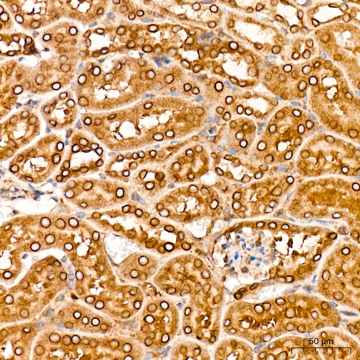 RanGAP1 Antibody (1E7R7)