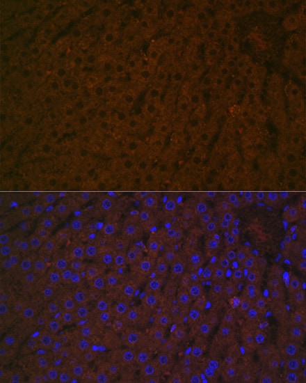 Haptoglobin Antibody (7C1N2)