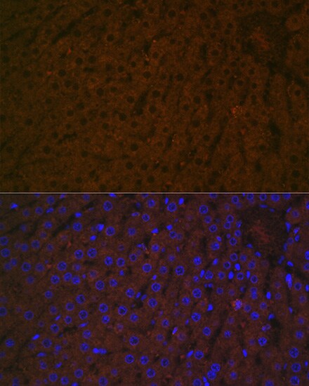 Haptoglobin Antibody (7C1N2)