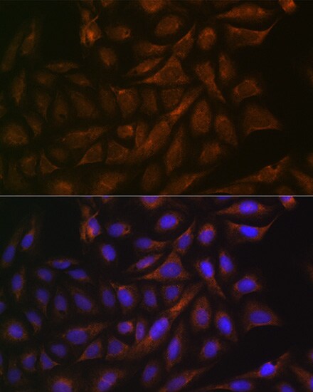 VAMP3/Cellubrevin Antibody (2H8R8)