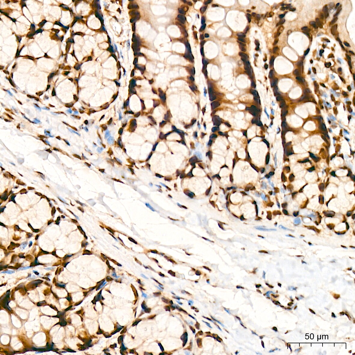 Bub3 Antibody (10G1S6)