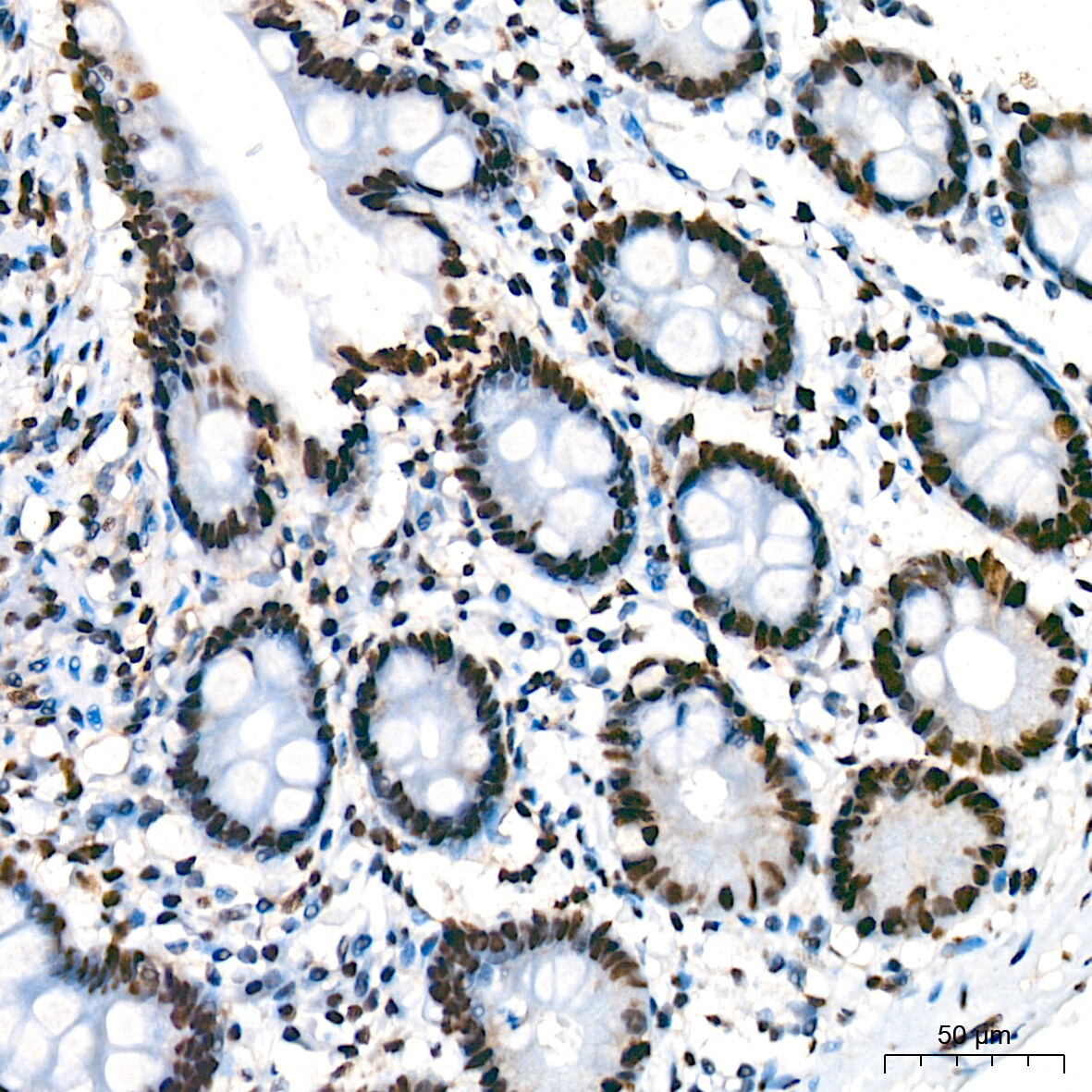 Bub3 Antibody (10G1S6)