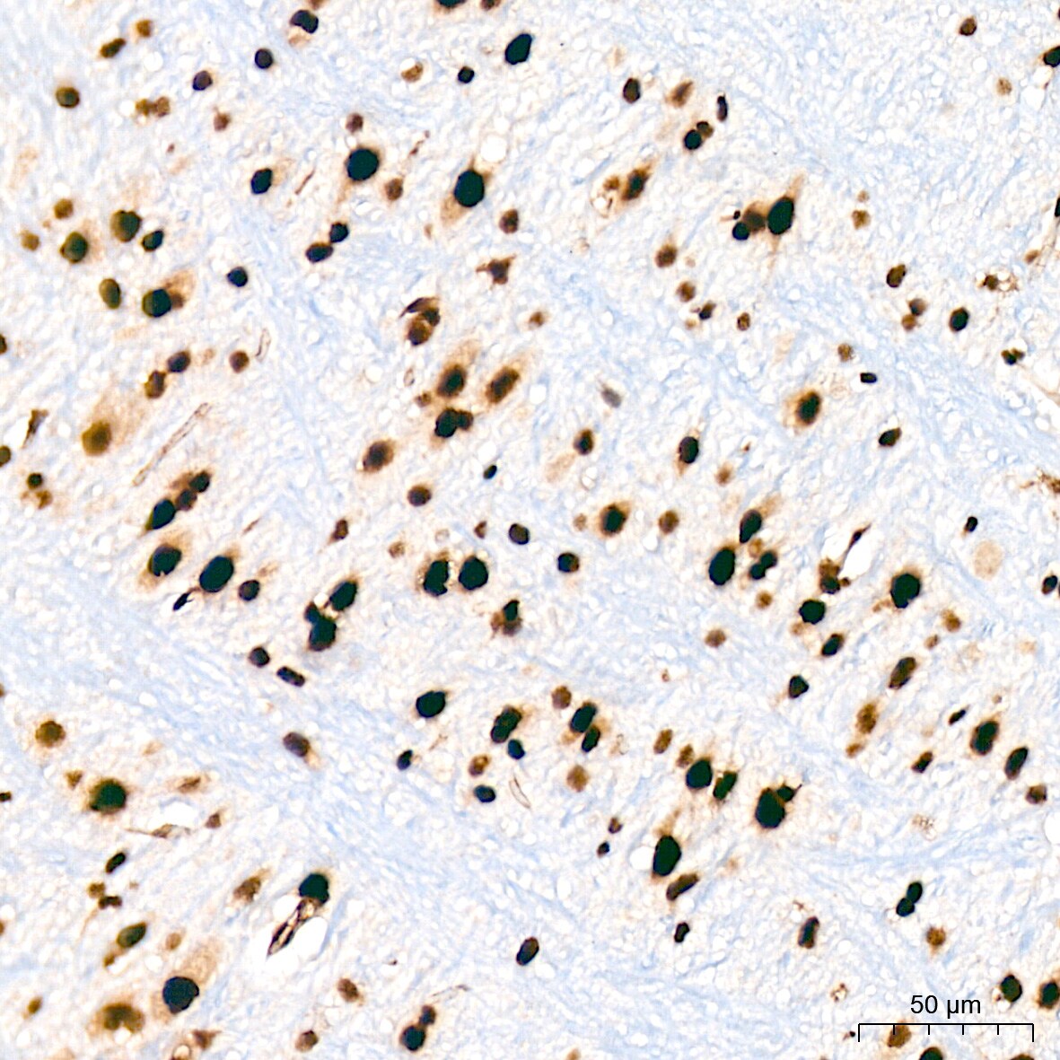 Bub3 Antibody (10G1S6)