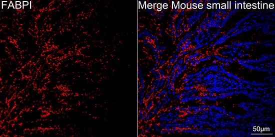 FABP2/I-FABP Antibody (5W9L6)