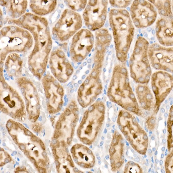 Pyruvate Dehydrogenase Kinase 1/PDK1 Antibody (5T6S8)