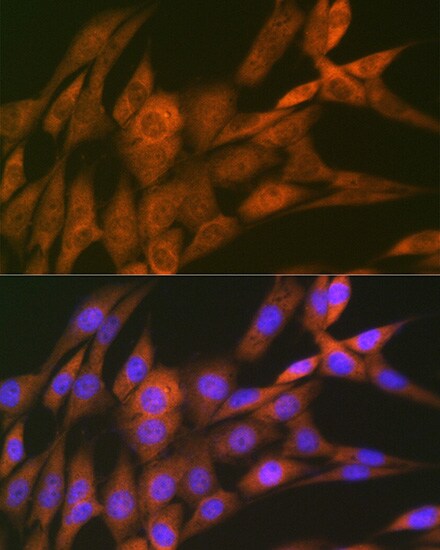 14-3-3 tau/theta Antibody (9G6M4)