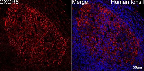 CXCR5 Antibody (9Q10I2)
