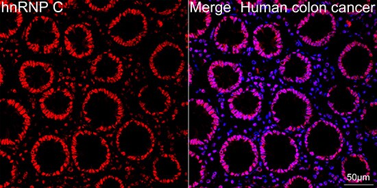 hnRNP C1 + C2 Antibody (7A10N5)