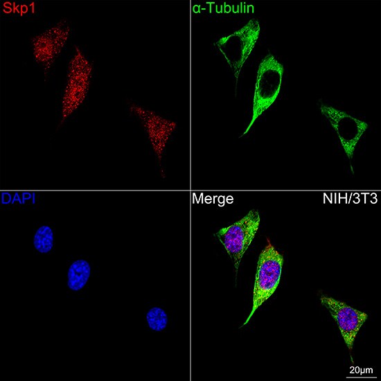 Skp1 Antibody (10G5X5)