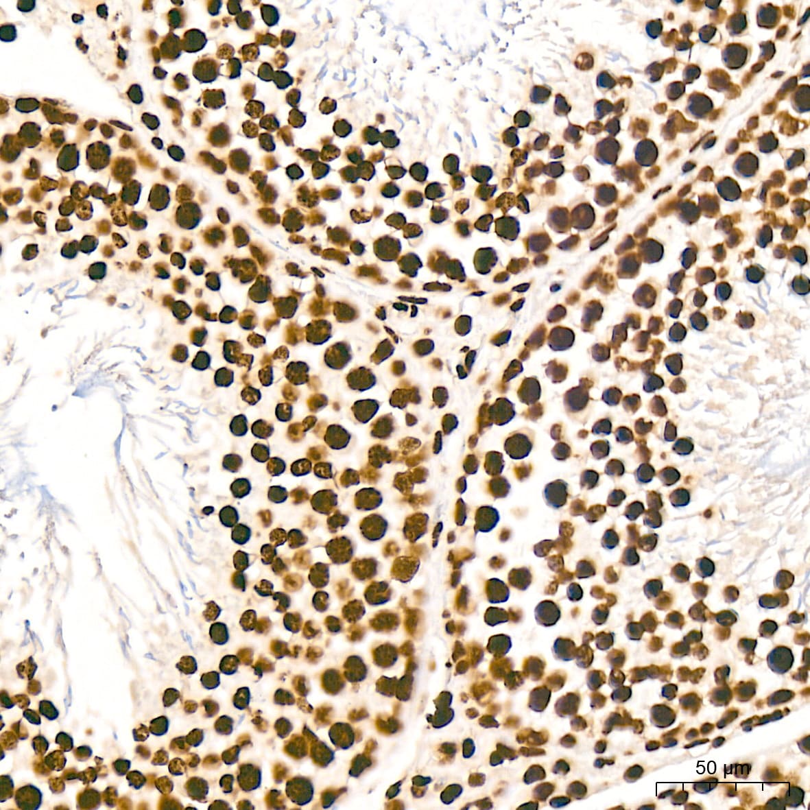 Histone H2AY/macroH2A.1 Antibody (4D2O4)