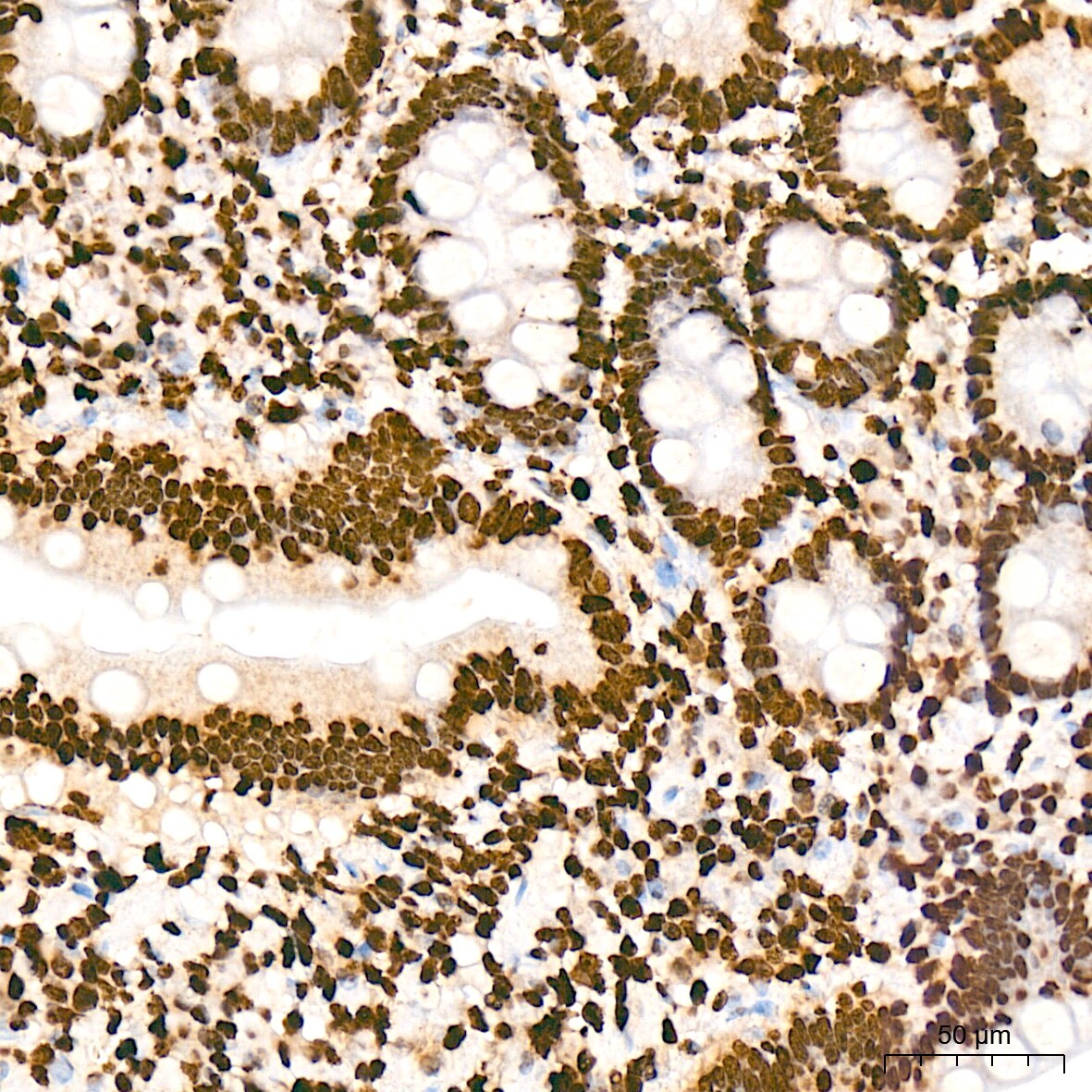 Histone H2AY/macroH2A.1 Antibody (4D2O4)