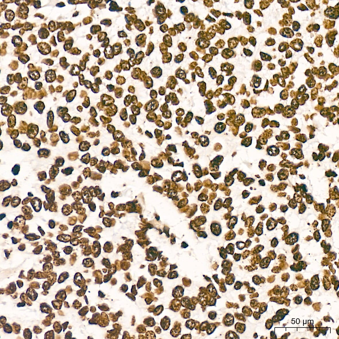 Histone H2AY/macroH2A.1 Antibody (4D2O4)