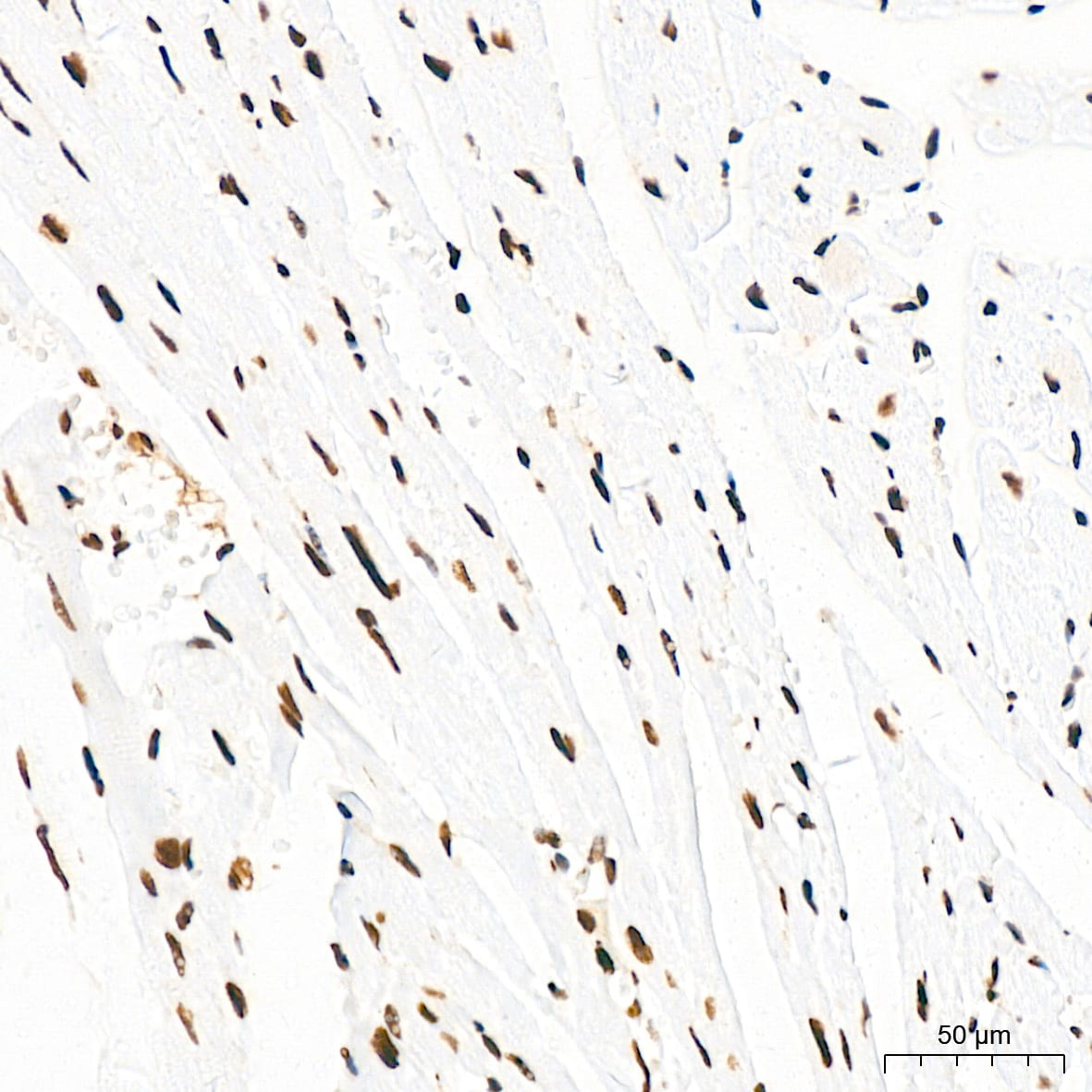 KHSRP Antibody (4V4O1)