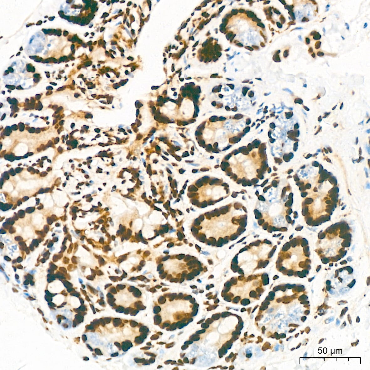 KHSRP Antibody (4V4O1)