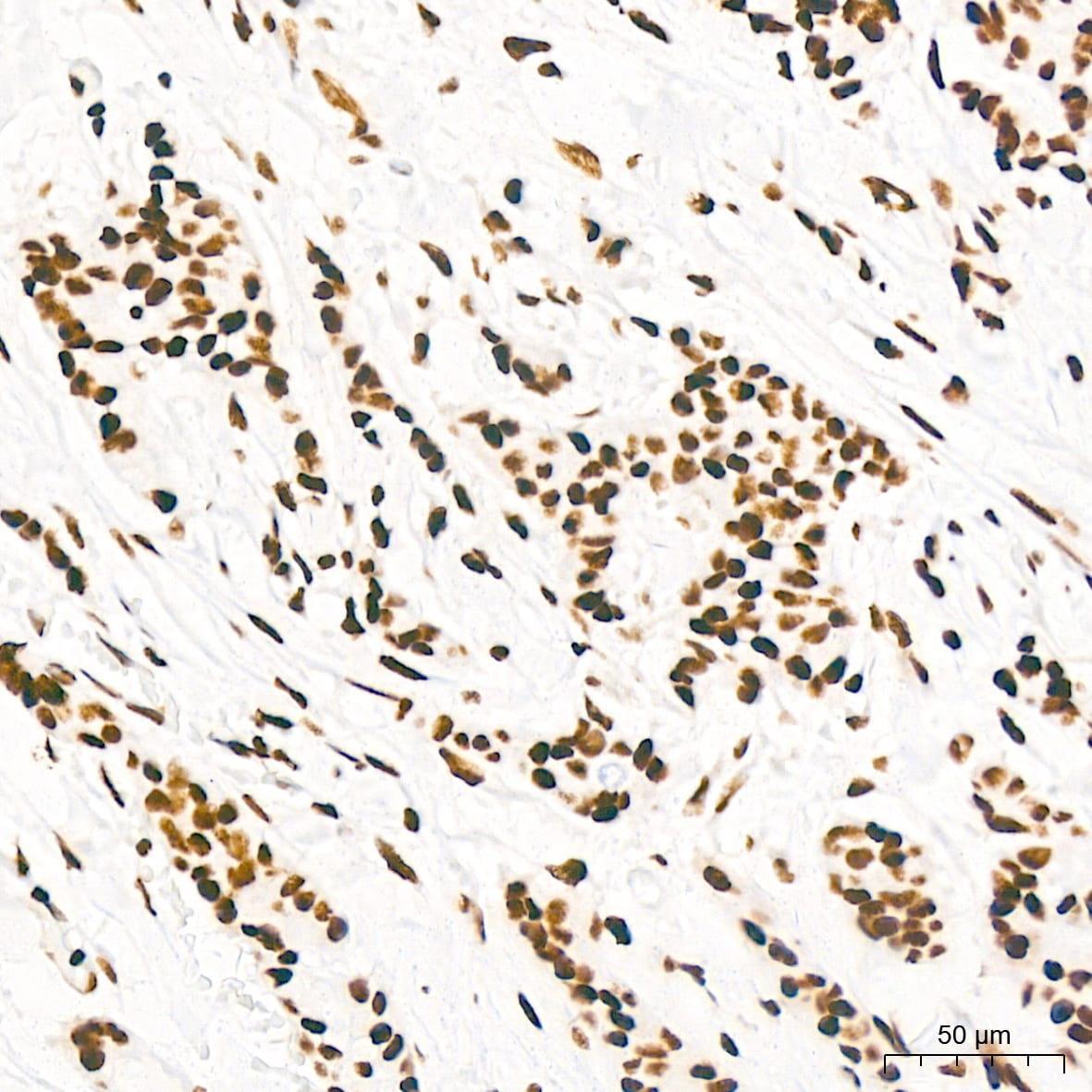 KHSRP Antibody (4V4O1)