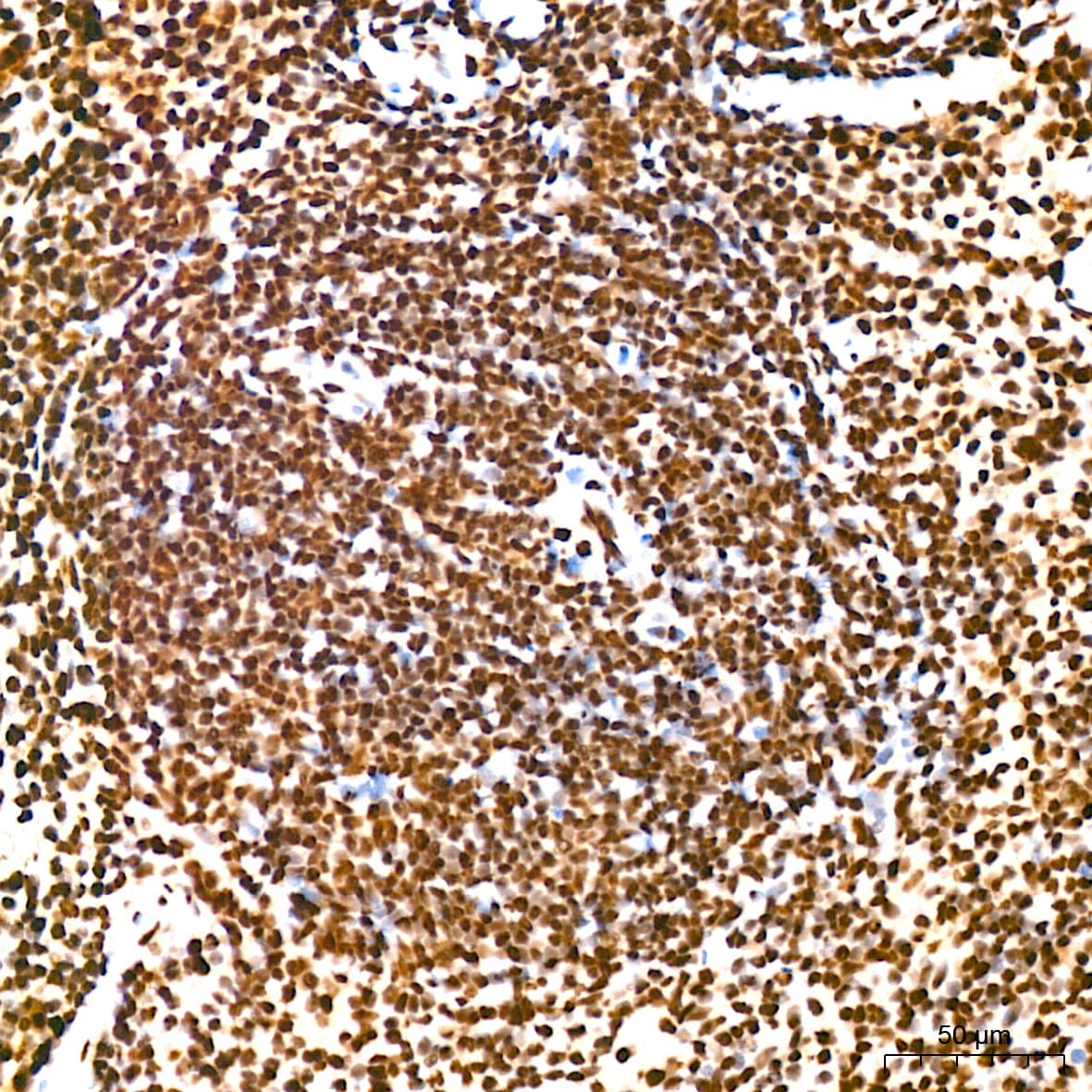 KHSRP Antibody (4V4O1)