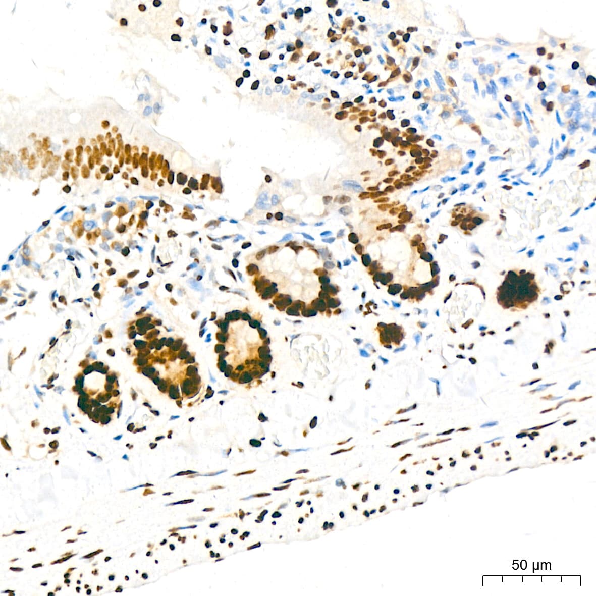 KHSRP Antibody (4V4O1)