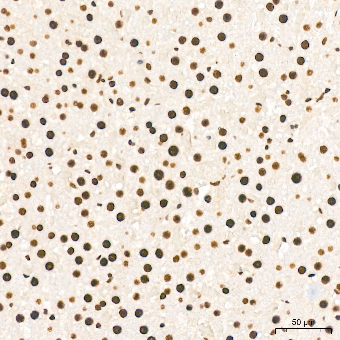 KHSRP Antibody (4V4O1)