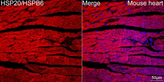 HSP20/HSPB6 Antibody (3J5N1)