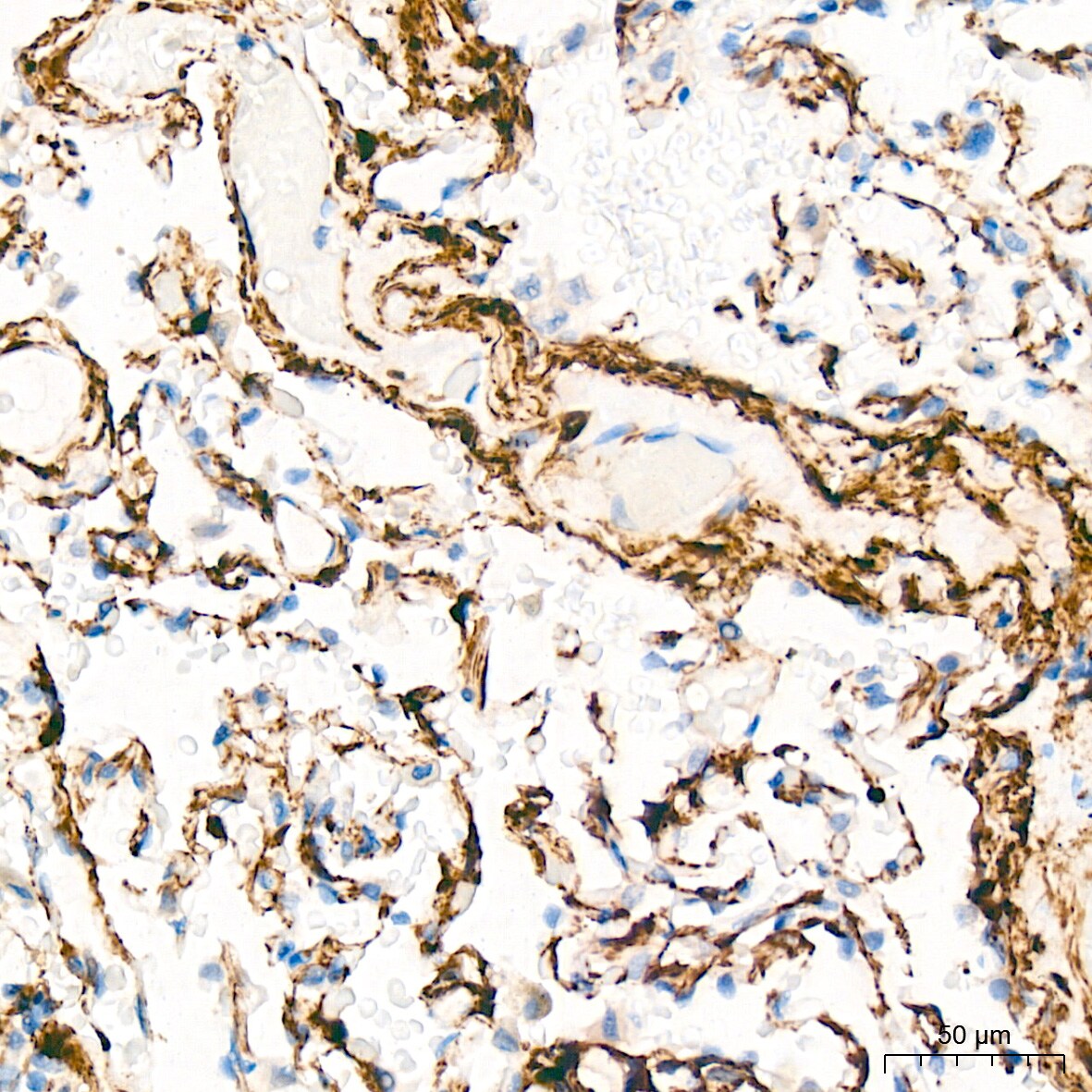 HSP20/HSPB6 Antibody (3J5N1)
